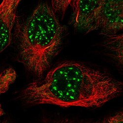 Invitrogen ZNF584 Polyclonal Antibody 100 &mu;L; Unconjugated:Antibodies,