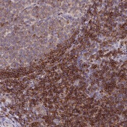 RASAL3 Polyclonal Antibody:Antibodies, Polyclonal