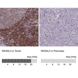 RASAL3 Polyclonal Antibody:Antibodies, Polyclonal