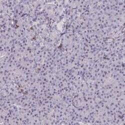 RASAL3 Polyclonal Antibody:Antibodies, Polyclonal