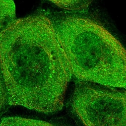 Invitrogen PHLB3 Polyclonal Antibody 100 &mu;L | Buy Online | Invitrogen&trade; | Fisher Scientific