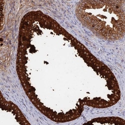 Invitrogen GPATCH1 Polyclonal Antibody 100 &mu;L; Unconjugated:Antibodies,