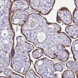 Invitrogen ADAMTS6 Polyclonal Antibody 100 &mu;L; Unconjugated:Antibodies,