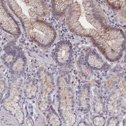 Invitrogen C4orf19 Polyclonal Antibody 100 &mu;L; Unconjugated:Antibodies,