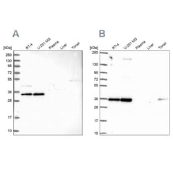 Invitrogen NOSIP Polyclonal Antibody 100 &mu;L | Buy Online | Invitrogen&trade; | Fisher Scientific