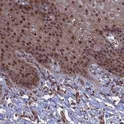 Invitrogen NOSIP Polyclonal Antibody 100 &mu;L | Buy Online | Invitrogen&trade; | Fisher Scientific