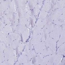 Invitrogen LZTFL1 Polyclonal Antibody 100 &mu;L; Unconjugated:Antibodies,
