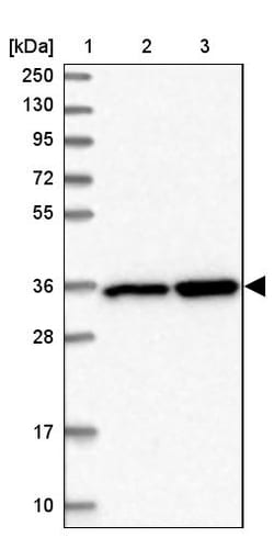 Invitrogen LZTFL1 Polyclonal Antibody 100 &mu;L | Buy Online | Invitrogen&trade; | Fisher Scientific
