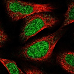 Invitrogen CCDC174 Polyclonal Antibody 100 &mu;L; Unconjugated:Antibodies,