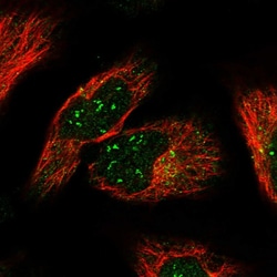 Invitrogen KIAA0922 Polyclonal Antibody 100 &mu;L; Unconjugated:Antibodies,