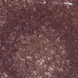 Invitrogen KIAA0922 Polyclonal Antibody 100 &mu;L; Unconjugated:Antibodies,