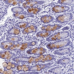 Invitrogen KDELR3 Polyclonal Antibody 100 &mu;L; Unconjugated:Antibodies,