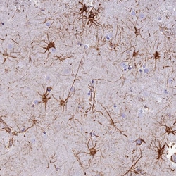Invitrogen C17orf67 Polyclonal Antibody 100 &mu;L; Unconjugated:Antibodies,