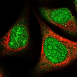 Invitrogen SRSF5 Polyclonal Antibody 100 &mu;L; Unconjugated:Antibodies,