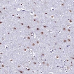 Invitrogen SRSF5 Polyclonal Antibody 100 &mu;L; Unconjugated:Antibodies,