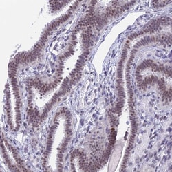 Invitrogen SRSF5 Polyclonal Antibody 100 &mu;L; Unconjugated:Antibodies,