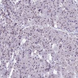 Invitrogen SRSF5 Polyclonal Antibody 100 &mu;L; Unconjugated:Antibodies,