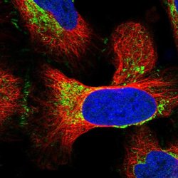 Invitrogen MRPS18B Polyclonal Antibody 100 &mu;L; Unconjugated:Antibodies,