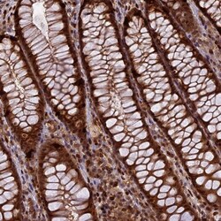 Invitrogen RABGGTA Polyclonal Antibody 100 &mu;L; Unconjugated:Antibodies,