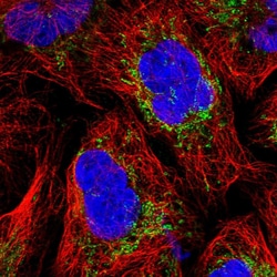 Invitrogen MRPS25 Polyclonal Antibody 100 &mu;L | Buy Online | Invitrogen&trade; | Fisher Scientific