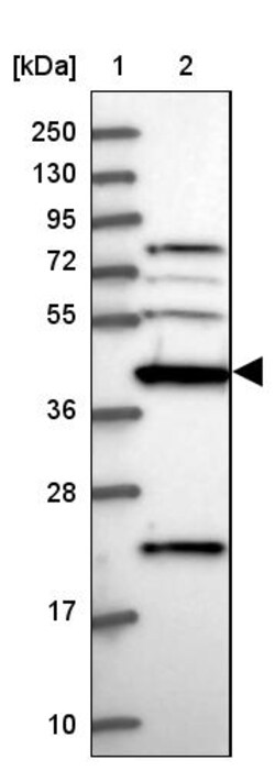 Invitrogen CKMT1A Polyclonal Antibody 100 &mu;L; Unconjugated:Antibodies,