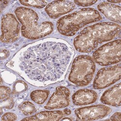 Invitrogen CHAC1 Polyclonal Antibody 100 &mu;L; Unconjugated:Antibodies,