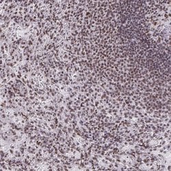 Invitrogen SNRNP70 Polyclonal Antibody 100 &mu;L; Unconjugated:Antibodies,