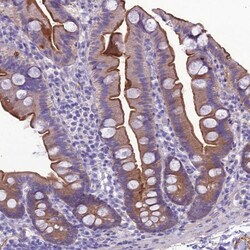Invitrogen&trade;&nbsp;ANKS4B Polyclonal Antibody