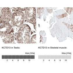 Invitrogen KCTD13 Polyclonal Antibody 100 &mu;L; Unconjugated:Antibodies,