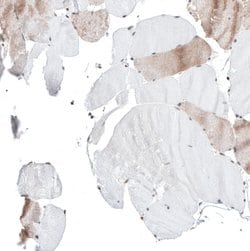 Invitrogen KCTD13 Polyclonal Antibody 100 &mu;L; Unconjugated:Antibodies,