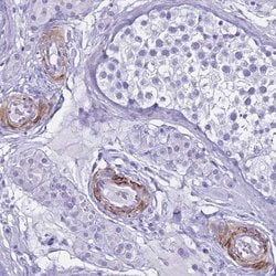 Invitrogen LCMT1 Polyclonal Antibody 100 &mu;L; Unconjugated:Antibodies,