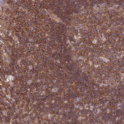 Invitrogen PPP1R12C Polyclonal Antibody 100 &mu;L; Unconjugated:Antibodies,
