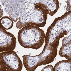 Invitrogen EPS8L1 Polyclonal Antibody 100 &mu;L; Unconjugated:Antibodies,