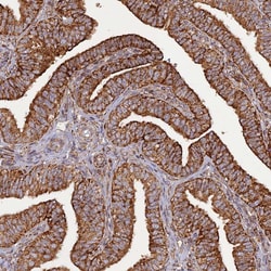 Invitrogen DYM Polyclonal Antibody 100 &mu;L; Unconjugated:Antibodies,