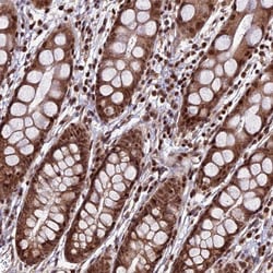 Invitrogen CIB3 Polyclonal Antibody 100 &mu;L; Unconjugated:Antibodies,