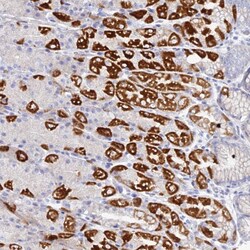 Invitrogen DHX34 Polyclonal Antibody 100 &mu;L; Unconjugated:Antibodies,