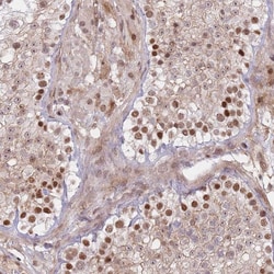 Invitrogen ERICH6B Polyclonal Antibody 100 &mu;L; Unconjugated:Antibodies,