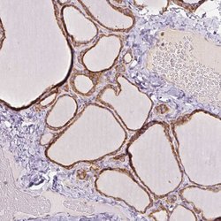 Invitrogen PRKCSH Polyclonal Antibody 100 &mu;L; Unconjugated:Antibodies,