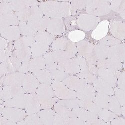 Invitrogen PRKCSH Polyclonal Antibody 100 &mu;L; Unconjugated:Antibodies,