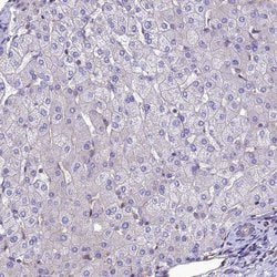 Invitrogen PPFIA3 Polyclonal Antibody 100 &mu;L; Unconjugated:Antibodies,