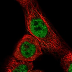 Invitrogen CCDC97 Polyclonal Antibody 100 &mu;L; Unconjugated:Antibodies,