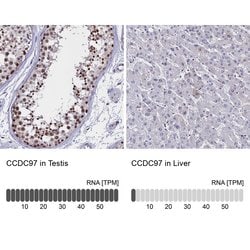 Invitrogen CCDC97 Polyclonal Antibody 100 &mu;L; Unconjugated:Antibodies,