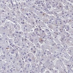 Invitrogen CCDC97 Polyclonal Antibody 100 &mu;L; Unconjugated:Antibodies,