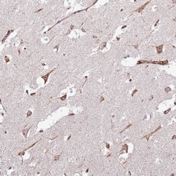 Invitrogen KRI1 Polyclonal Antibody 100 &mu;L; Unconjugated:Antibodies,