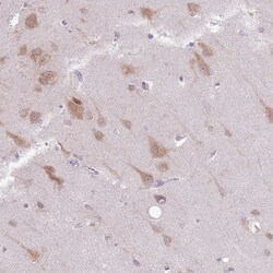 Invitrogen COPE Polyclonal Antibody 100 &mu;L; Unconjugated:Antibodies,