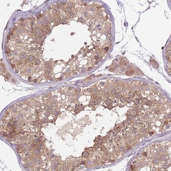 Invitrogen COPE Polyclonal Antibody 100 &mu;L; Unconjugated:Antibodies,