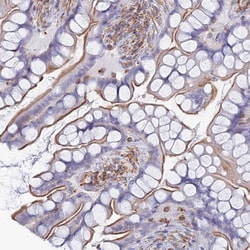 Invitrogen MIC-1 Polyclonal Antibody 100 &mu;L; Unconjugated:Antibodies,