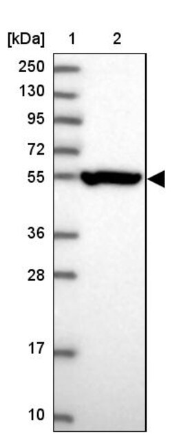 Invitrogen CRTAP Polyclonal Antibody 100 &mu;L | Buy Online | Invitrogen&trade; | Fisher Scientific