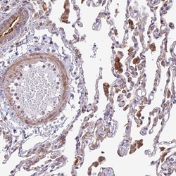 Invitrogen TBC1D20 Polyclonal Antibody 100 μL; Unconjugated:Antibodies,