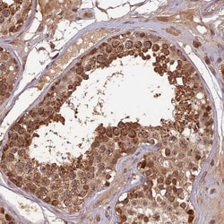 Invitrogen RGL3 Polyclonal Antibody 100 &mu;L; Unconjugated:Antibodies,